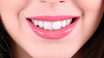 i sintomi della carie dentale